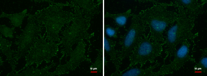 Anti-AOC2 antibody used in ICC/IF. GTX112397
