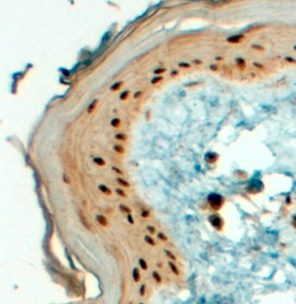 Anti-AP2 gamma antibody, C-term used in IHC (Formalin-fixed paraffin-embedded sections). GTX89567