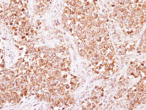 Anti-AP2B1 antibody used in IHC (Formalin-fixed paraffin-embedded sections). GTX112479