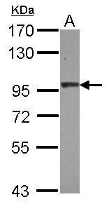 Anti-AP2B1 antibody used in Western blot. GTX112479