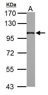 Anti-AP2B1 antibody used in Western blot. GTX112479
