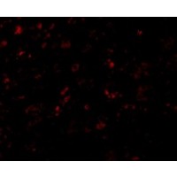 Anti-AP2M1 antibody used in ICC/IF. GTX85110
