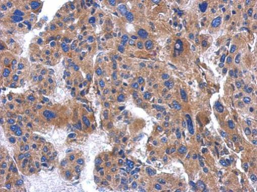 Anti-AP3M2 antibody [N1C1] used in IHC (Formalin-fixed paraffin-embedded sections). GTX115508