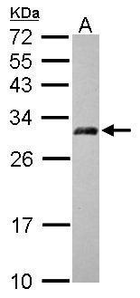 Anti-AP3M2 antibody [N1C1] used in Western blot. GTX115508