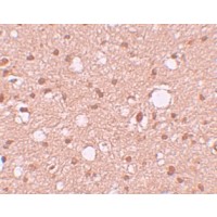 Anti-APBA2 antibody used in Immunohistochemistry. GTX85144
