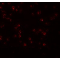 Anti-APC13 antibody used in ICC/IF. GTX85186