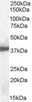 Anti-APE1 antibody, N-term used in Western blot. GTX89912