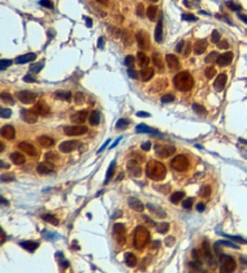 Anti-APE1 antibody, N-term used in IHC (Formalin-fixed paraffin-embedded sections). GTX89912