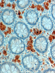 Anti-APOA4 antibody, Internal used in IHC (Formalin-fixed paraffin-embedded sections). GTX89166