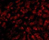 Anti-Apolipoprotein A1 antibody used in ICC/IF. GTX85115