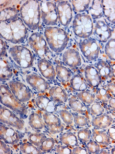 Anti-apolipoprotein A-IV antibody, Internal used in IHC (Formalin-fixed paraffin-embedded sections). GTX88533