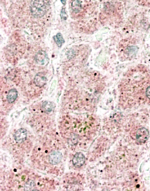 Anti-Apolipoprotein F antibody, C-term used in IHC (Formalin-fixed paraffin-embedded sections). GTX88675