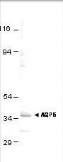 Anti-Aquaporin 6 antibody used in Western blot. GTX47918