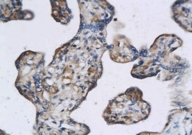 Anti-Aquaporin 9 antibody used in IHC (Formalin-fixed paraffin-embedded sections). GTX37783