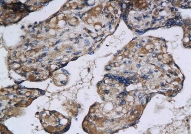 Anti-Aquaporin 9 antibody used in IHC (Formalin-fixed paraffin-embedded sections). GTX37783