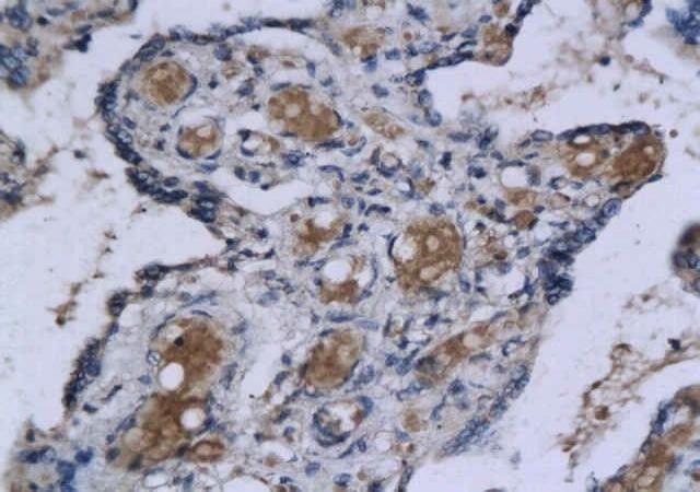 Anti-Aquaporin 9 antibody used in IHC (Formalin-fixed paraffin-embedded sections). GTX37783