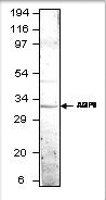 Anti-Aquaporin 9 antibody used in Western blot. GTX47916