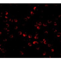 Anti-ARF-BP1 antibody used in ICC/IF. GTX85051