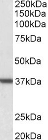 Anti-Arginase, type 1 / ARG1 antibody, C-term used in Western blot. GTX89098