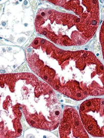 Anti-Argininosuccinate synthetase 1 antibody, Internal used in IHC (Formalin-fixed paraffin-embedded sections). GTX89088