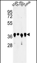 Anti-ARGLU1 antibody, N-term used in Western blot. GTX80436