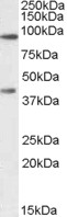 Anti-ABCB5 antibody, Internal used in Western blot. GTX88894