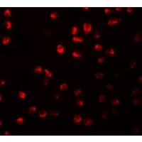 Anti-ARHGAP18 antibody used in ICC/IF. GTX85208