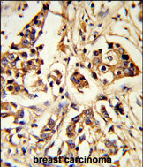 Anti-ARHGAP18 antibody, Internal used in IHC (Formalin-fixed paraffin-embedded sections). GTX81203