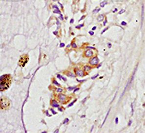 Anti-ARHGAP24 antibody used in IHC (Formalin-fixed paraffin-embedded sections). GTX51654