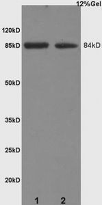 Anti-ARHGAP24 antibody used in Western blot. GTX51654