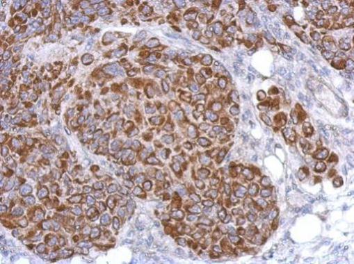 Anti-ARHGAP9 antibody used in IHC (Formalin-fixed paraffin-embedded sections). GTX119870