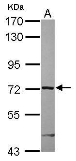 Anti-ARHGAP9 antibody used in Western blot. GTX119870