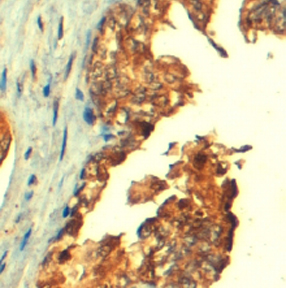 Anti-ABCC4 / MRP4 antibody, C-term used in IHC (Formalin-fixed paraffin-embedded sections). GTX89659