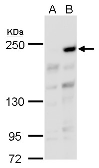 Anti-ARID2 antibody used in Western blot. GTX129443