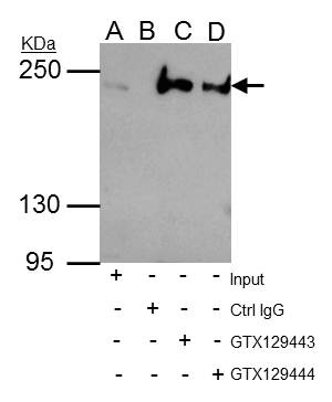Anti-ARID2 antibody used in Immunoprecipitation. GTX129443