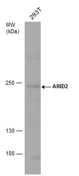 Anti-ARID2 antibody used in Western blot. GTX129444