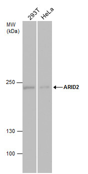 Anti-ARID2 antibody [GT7311] used in Western blot. GTX632011