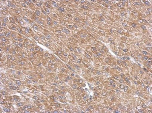 Anti-ARL13B antibody used in IHC (Formalin-fixed paraffin-embedded sections). GTX122703