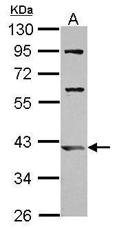 Anti-ARL13B antibody used in Western blot. GTX122703
