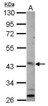 Anti-ARL13B antibody used in Western blot. GTX122703