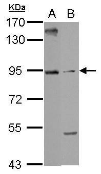 Anti-ARMC3 antibody used in Western blot. GTX123050