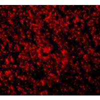 Anti-ARMER antibody used in ICC/IF. GTX85516