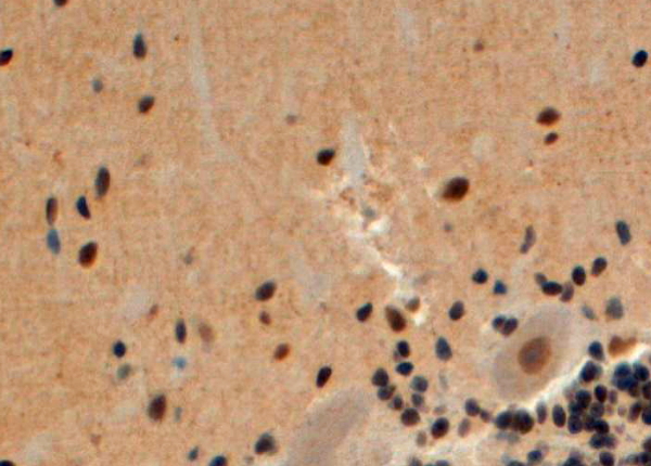 Anti-Arrestin beta 2 antibody, Internal used in IHC (Formalin-fixed paraffin-embedded sections). GTX47600