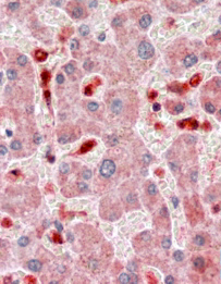 Anti-ASC / TMS1 antibody, C-term used in IHC (Formalin-fixed paraffin-embedded sections). GTX22236