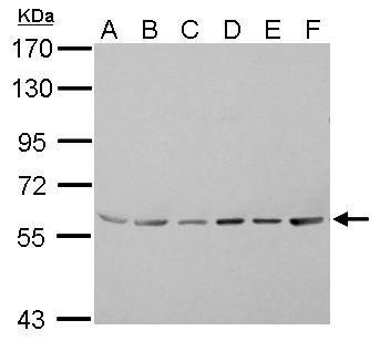 Anti-ASC1 antibody used in Western blot. GTX105780