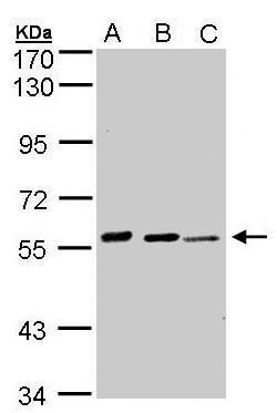 Anti-ASE antibody [C2C3], C-term used in Western blot. GTX101335