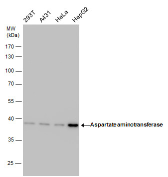 Anti-Aspartate aminotransferase antibody [GT1255] used in Western blot. GTX632033