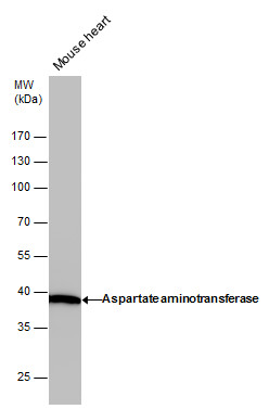 Anti-Aspartate aminotransferase antibody [GT1255] used in Western blot. GTX632033