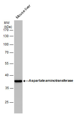 Anti-Aspartate aminotransferase antibody [GT1255] used in Western blot. GTX632033