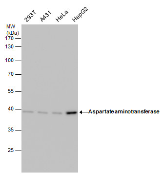 Anti-Aspartate aminotransferase antibody [GT1342] used in Western blot. GTX632032